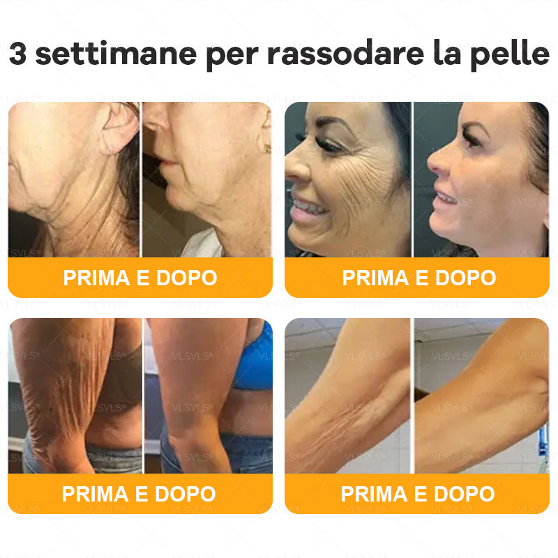 VLSVLS® ✨🎁 Solo 5 confezioni rimaste! Ti offriamo un ulteriore sconto del 30%! Mettiti in forma e prenditi cura della tua salute. Se perdi questa occasione, non avrai un’altra possibilità fino al prossimo anno.
