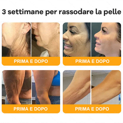 VLSVLS® ✨🎁 Solo 5 confezioni rimaste! Ti offriamo un ulteriore sconto del 30%! Mettiti in forma e prenditi cura della tua salute. Se perdi questa occasione, non avrai un’altra possibilità fino al prossimo anno.