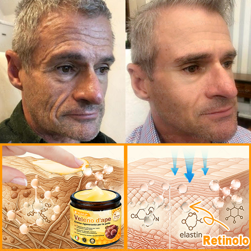 VLSVLS® ✨🎁 Solo 5 confezioni rimaste! Ti offriamo un ulteriore sconto del 30%! Mettiti in forma e prenditi cura della tua salute. Se perdi questa occasione, non avrai un’altra possibilità fino al prossimo anno.