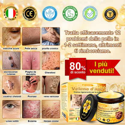 VLSVLS® ✨🎁 Solo 5 confezioni rimaste! Ti offriamo un ulteriore sconto del 30%! Mettiti in forma e prenditi cura della tua salute. Se perdi questa occasione, non avrai un’altra possibilità fino al prossimo anno.