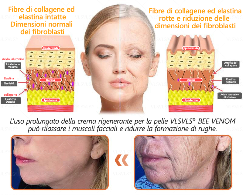VLSVLS® ✨🎁 Solo 5 confezioni rimaste! Ti offriamo un ulteriore sconto del 30%! Mettiti in forma e prenditi cura della tua salute. Se perdi questa occasione, non avrai un’altra possibilità fino al prossimo anno.