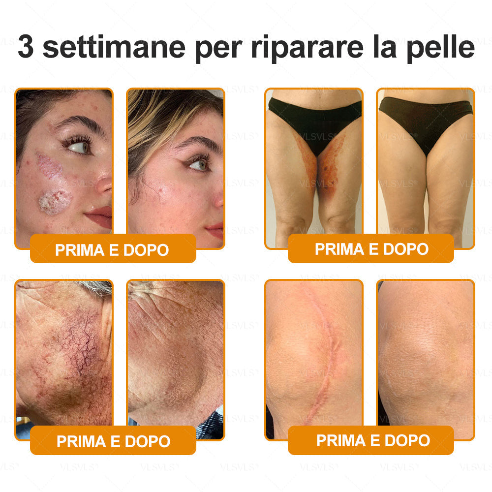VLSVLS® ✨🎁 Solo 5 confezioni rimaste! Ti offriamo un ulteriore sconto del 30%! Mettiti in forma e prenditi cura della tua salute. Se perdi questa occasione, non avrai un’altra possibilità fino al prossimo anno.