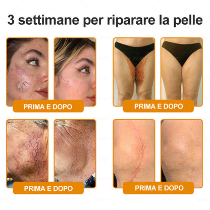 VLSVLS® ✨🎁 Solo 5 confezioni rimaste! Ti offriamo un ulteriore sconto del 30%! Mettiti in forma e prenditi cura della tua salute. Se perdi questa occasione, non avrai un’altra possibilità fino al prossimo anno.