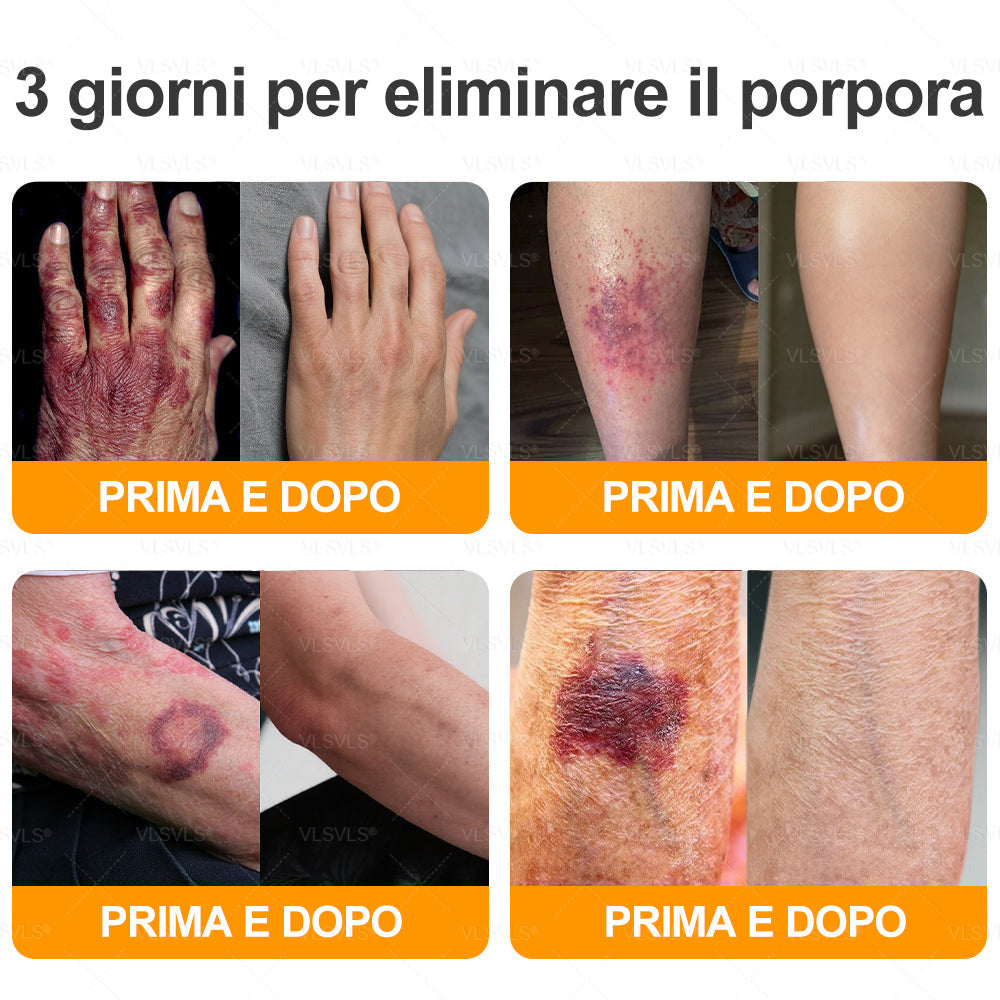 VLSVLS® ✨🎁 Solo 5 confezioni rimaste! Ti offriamo un ulteriore sconto del 30%! Mettiti in forma e prenditi cura della tua salute. Se perdi questa occasione, non avrai un’altra possibilità fino al prossimo anno.
