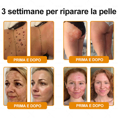 VLSVLS® ✨🎁 Solo 5 confezioni rimaste! Ti offriamo un ulteriore sconto del 30%! Mettiti in forma e prenditi cura della tua salute. Se perdi questa occasione, non avrai un’altra possibilità fino al prossimo anno.