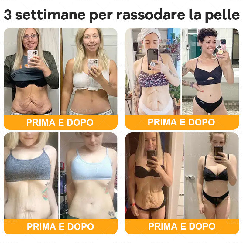 VLSVLS® ✨🎁 Solo 5 confezioni rimaste! Ti offriamo un ulteriore sconto del 30%! Mettiti in forma e prenditi cura della tua salute. Se perdi questa occasione, non avrai un’altra possibilità fino al prossimo anno.